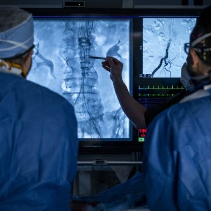 Surgical teams use image guided technology to complete a vascular procedure at KHSC