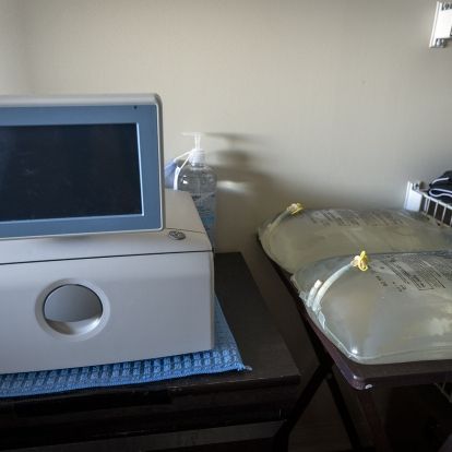 A dialysis cycling machine and dialysis fluid.