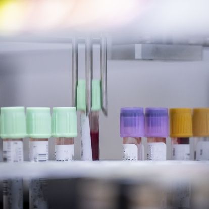 KHSC's laboratory robotics testing a series of blood vials.