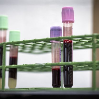 Low-volume collection tubes next to standard tubes.