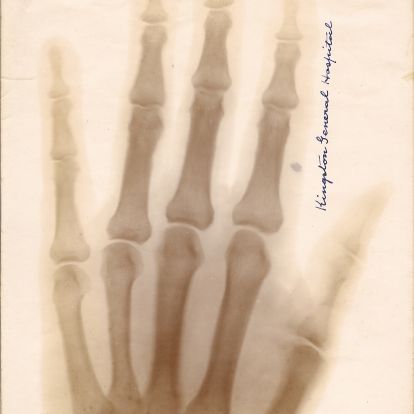 X-ray