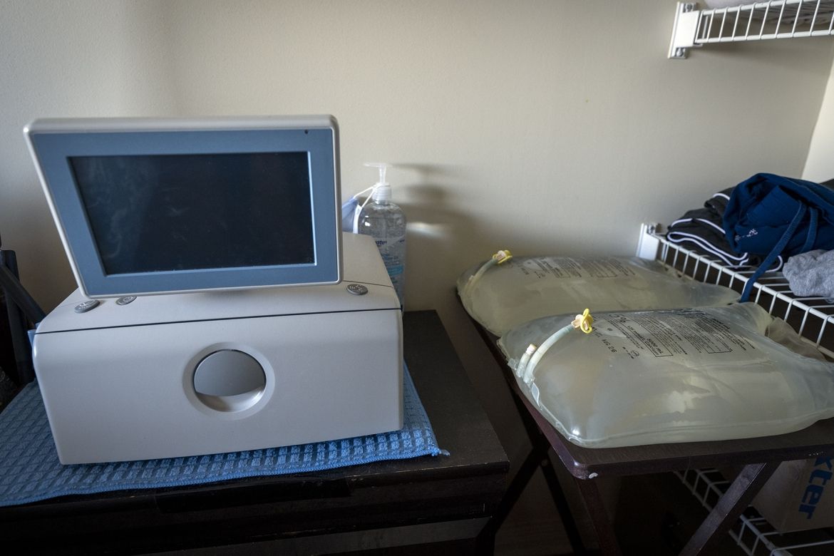 A dialysis cycling machine and dialysis fluid.