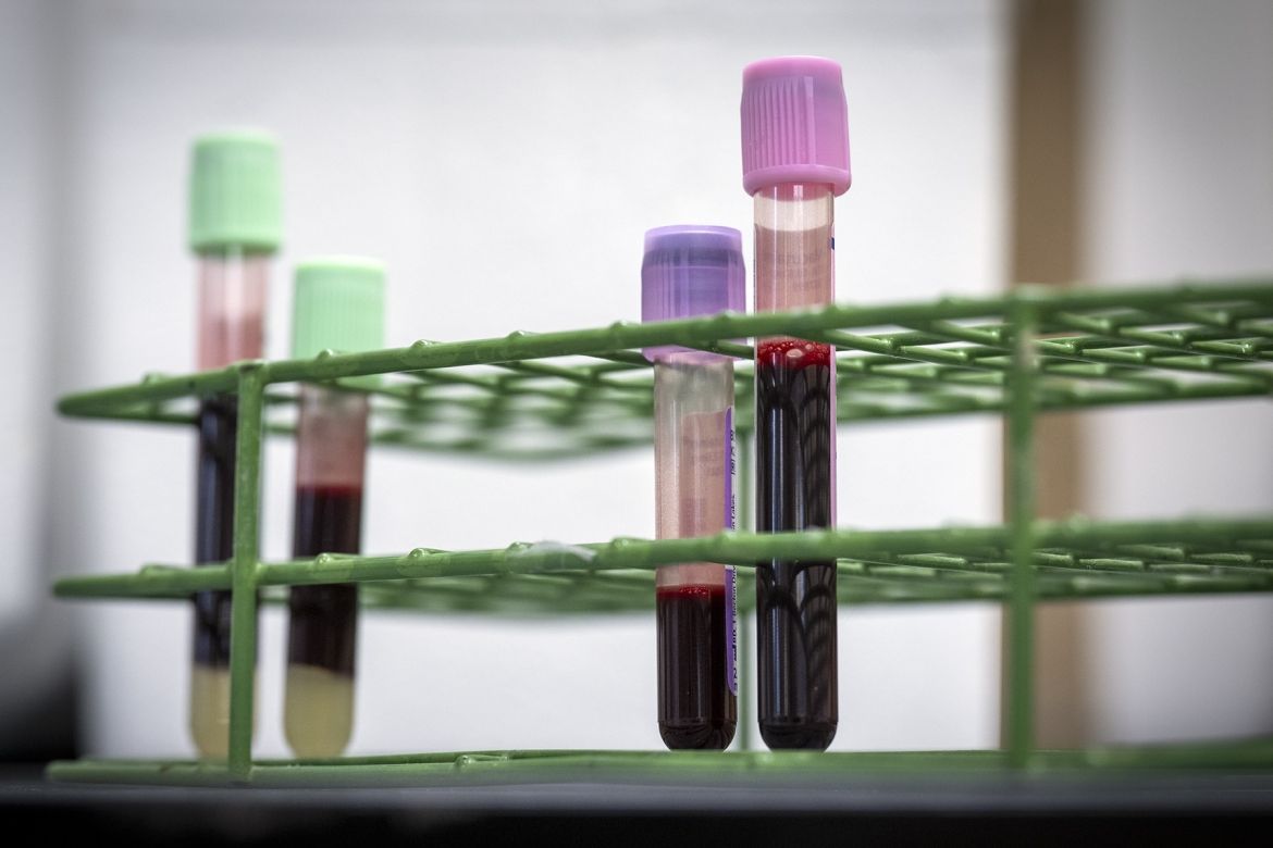 Low-volume collection tubes next to standard tubes.