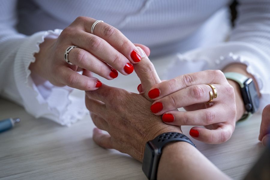 A close up shot of Andreea Bocicariu examining a patient’s hand. Both of Bocicariu’s hands are on the patient’s thumb, examining its movement.