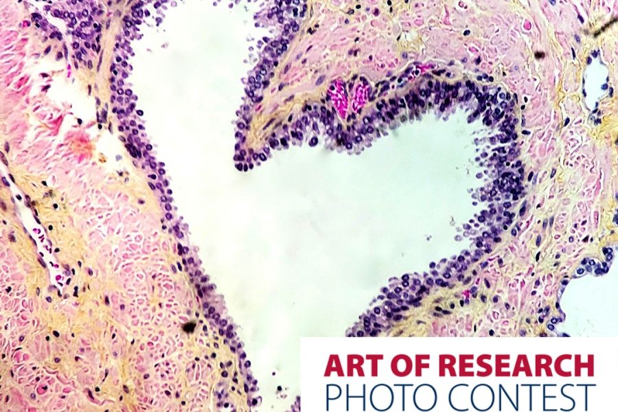 "Love Under the Microscope" by Dalila Villalobos, MD, Resident (Anatomical Pathology)